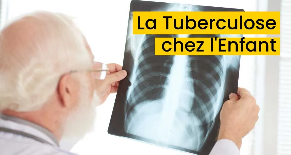 La Tuberculose chez l'Enfant